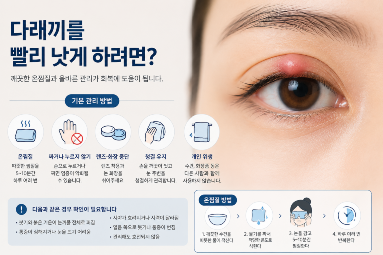 다래끼 빨리 낫는 법과 올바른 온찜질 관리