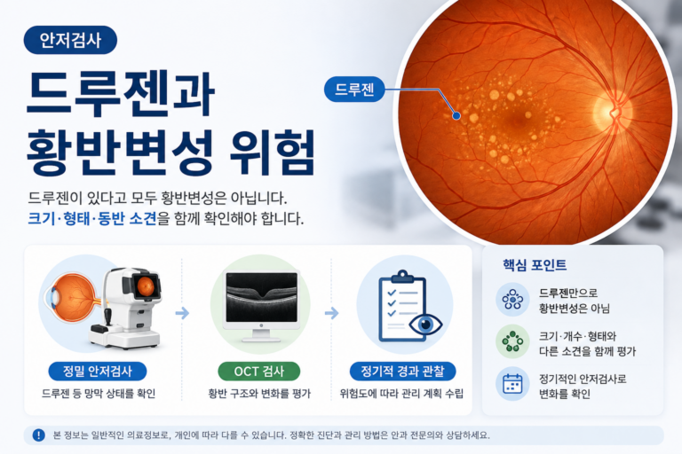안저검사에서 발견되는 드루젠과 황반변성 위험 평가의 관계를 설명하는 의료정보 이미지